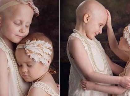 A három rákkal küzdő kislány 2014-ben áll fényképezőgép elé – a 2018-ban készült fotóik igen meghatóak