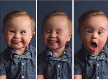 BÁMULATOS: Igazi modell lehet a megalázott Down-szindrómás kisfiúból. Csodálatos felvételek! ❤ Mennyi szívet adnátok ennek a drága kis csöppségnek?