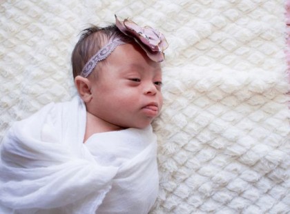 AZ ORVOSOK AZT MONDTÁK MENJEN HAZA ÉS MAJD SZÜLJÖN MÁSIKAT! NÉZD MEG MOST A DOWN-SZINDRÓMÁS IKREKET!