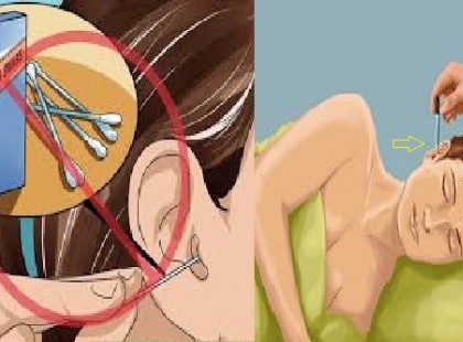 2 CSEPPNYI A FÜLEDBE ÉS MEGJAVULHAT A HALLÁSOD! MÉG A 70-80 ÉVES IDŐSEK IS NAGY JAVULÁST TAPASZTALTAK