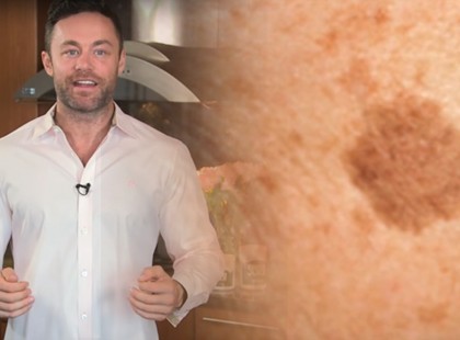 A híres bőrgyógyász elmondta a titkot: szabadulj meg a barna foltoktól és öregségi ráncoktól ezzel a filléres trükkel! –