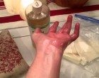 Azt tudtad, hogy jó a hajnak, de a ricinusolaj így mulasztja el az ízületek fájdalmait rövid idő alatt