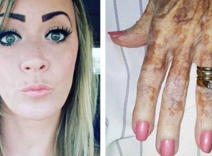 Az idős hölgy azt mondta csúnyák a kezei -az ápolónő válaszát most az egész világ ünnepli