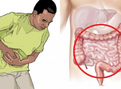 Hasi puffadás: Így lehet megszüntetni az orvos tudomány nélkül