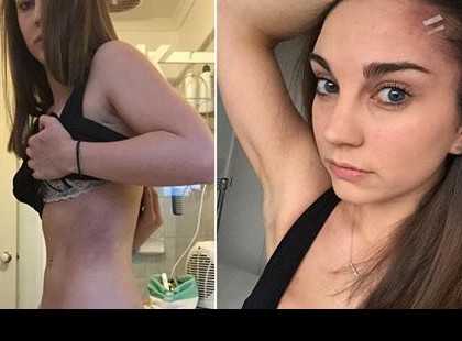 A lányt megtámadták, de a férfi nem tudta, hogy a lány 15 éve karatézik..