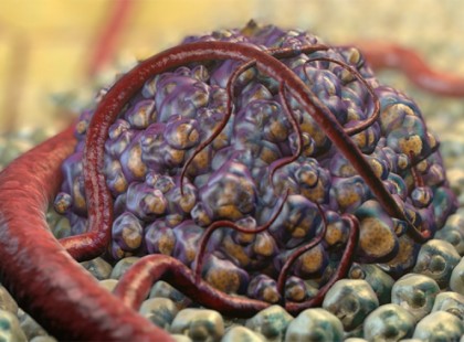 Áttörés! Kutatók megtalálták a sejtet, ami nem engedi növekedni a tumort, a rák ellenszerének újabb mérföldkövéhez értek a tudósok