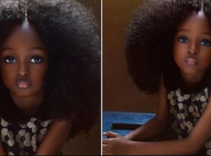 Az 5 éves kislányt a 