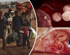 Halálos paraziták jutnak be Európába a menekültekkel együtt: a világ tudósai és a WHO figyelmeztet!