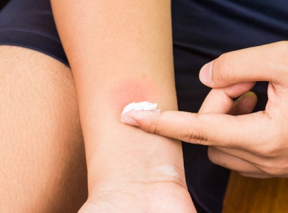 Az anya meghalt, miután megcsípte egy ismert bogár. Most a család mindenkit figyelmeztet