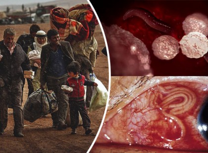 Halálos paraziták jutnak be Európába a menekültekkel együtt: a világ tudósai és a WHO figyelmeztet!