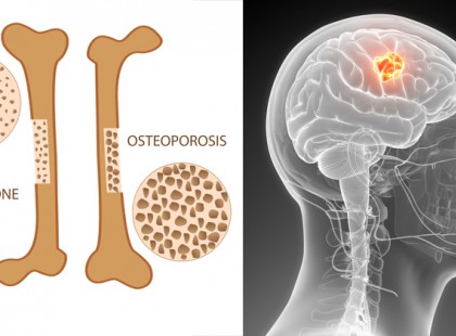 Ez a mindennapi ital megöli a csontjaidat, rákot és cukorbajt okoz, mégis mindenki issza