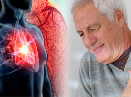 Kerüld el a szívrohamot és a stroke-ot: 10 élelmiszer, amit kötelezően fogyasztanod kellene!