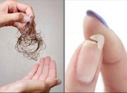 Ezért hullik a hajad ,törik a körmöd !