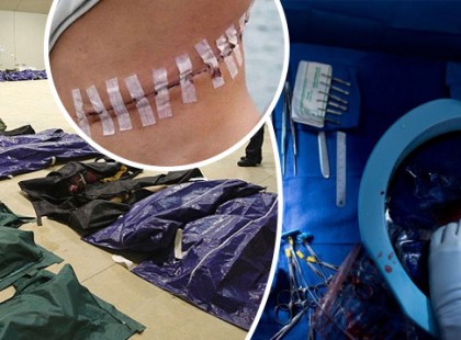 Szervek nélküli holttesteket találtak az utcákon! Szervkereskedelem tizedeli meg a bevándorlókat?