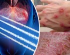Világszerte emelkedik a chemtrail-betegek száma: a Föld globális mérgezése zajlik?