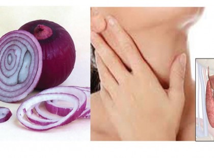 Csak egy lilahagymát dörzsölt a torkához, és megszűnt egy régi betegsége, az orvos is igazolta