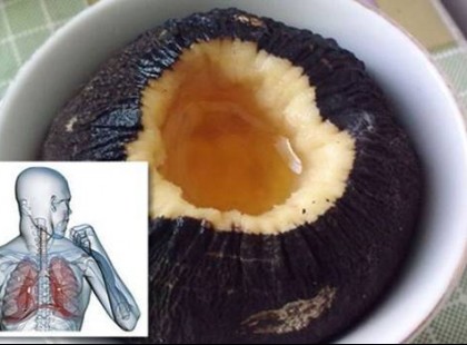 3 erős házi gyógymód, ami 1-2 nap alatt felszaggatja a váladékot a tüdőből és megszünteti a köhögést