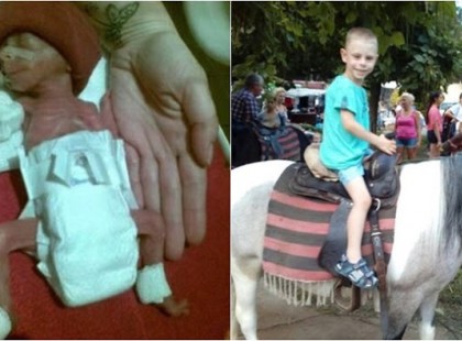 Imádkoztam Istenhez, hogy a 380 grammal világra jött kisfiamat lássam felnőni.. Az orvosok sem hittek benne! Most 7 éves.. Üzenném nektek sose adjátok fel! Kérlek támogassátok az én kicsikémet néhány jó szóval, ha szerintetek is megérdemli! Ő itt az én hősöm: