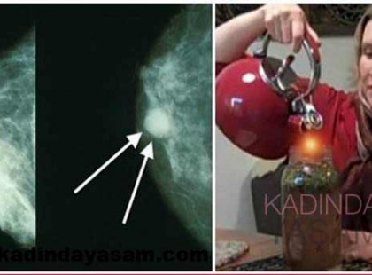 Ez a nő egy teával gyógyult ki a rákból, most mindenkinek el akarja mondani, mit ivott