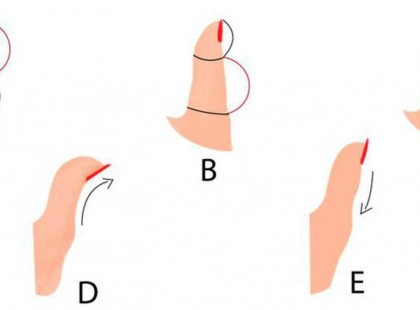 Tudtad?A hüvelykujjad formája sok mindent elárul rólad! Meglepő, de nagyon összetett jellemzés!