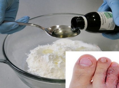 A ricinusolaj és a szódabikarbóna együttes hatása 20 betegség kezelésére alkalmas!