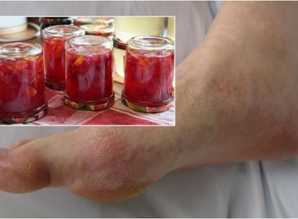 Természetes és Garantált gyógymód az ízületekre, a hátra és a lábakra! A fájdalom 1 hónap alatt megszűnik! - Adjátok tovább gyógyulni akaró embertársaitoknak!