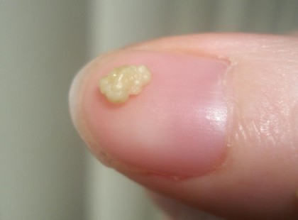 Ettől büdös az emberek 90%-nak a szája.