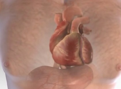 Animáción keresztül fedjük fel, mi történik a testben szívroham esetén