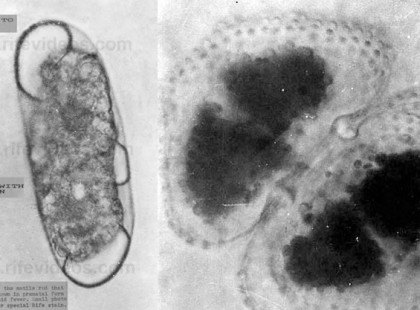 Ezt az 5 dolgot a gyógyszeripar titkolta el előlünk, saját profitja érdekében!