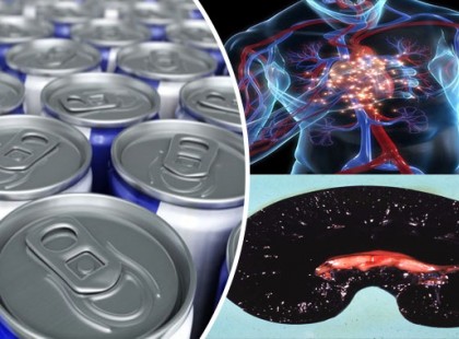 ​Az agyon koffeinezett energia italok és az alkohol keveréke a legkárosabb, mely hosszabb távon halálhoz is vezethet.