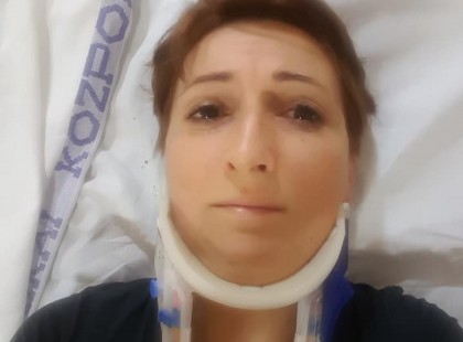 A szegedi vadasparkban a fejére esett egy fatörzs ennek a hölgynek. Keresi a megmentőjét