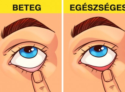 7 egyszerű orvosi vizsgálat, amit akár saját magunkon is elvégezhetünk