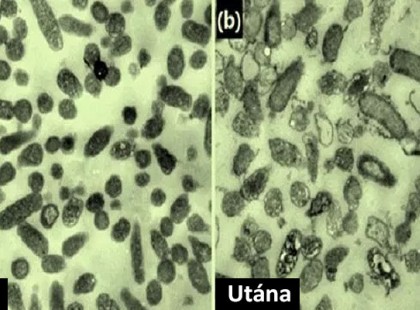 A rákos sejtek elpusztítják önmaguk a kannabisz hatására: felvételen a bizonyíték!