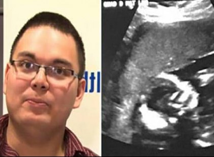 A nő férje majdnem elájul, amikor meglátja az ultrahangot. A nővér a képernyőre néz és azt mondja: “Az esély 1 a 15 millióhoz”