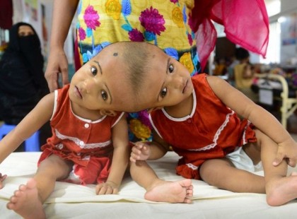Egyedül a magyar orvosok menthetik meg ezeket a gyerekeket