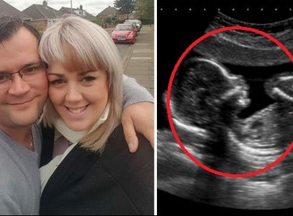 Ezt fedezték fel a méhében, szinte elájultak a doktorok