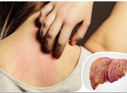 Innen tudod, hogy a májad “haldoklik”!