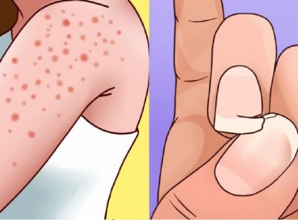 8 jele, hogy gluténérzékeny vagy – fontos, hogy tudj róla