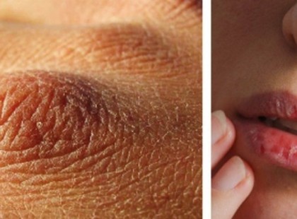 Ez a 8 szemmel látható jele annak, hogy kevés vizet iszunk