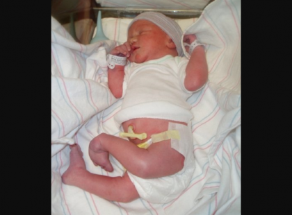 A kislány fordított térdekkel születik. Mikor 8 évvel később visszatér a kórházba, az orvosok elalélnak: