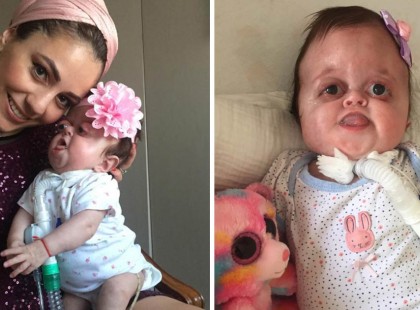 Az 1 éves, súlyos fogyatékossággal élő kislány megjelenésén gúnyolódnak az interneten