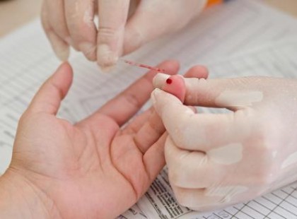 Ha 0-ás vércsoportod van, ezt a 8 dolgot kell tudnod