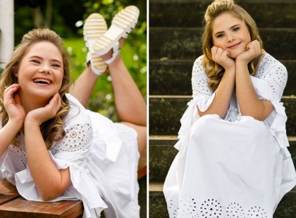 Ünnepelt modell lett a Down-szindrómás kislány