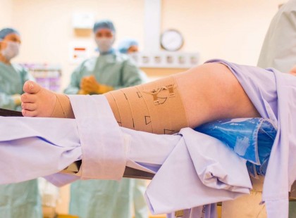 A trombózis 5 tünete, amivel azonnal orvoshoz kell menni