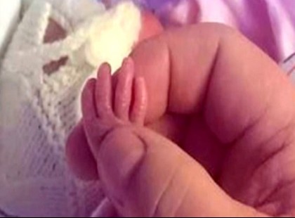 A baba csupán 2 nappal született az abortusz határ felett, de nem adta fel. Így néz ki 9 hónap után!