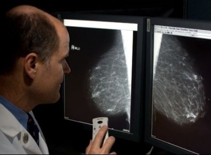 FIGYELEM!Naponta isszuk és nem is sejtjük, hogy mellrákot okoz!