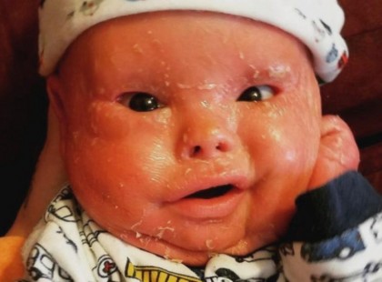 Az anya hipós vízben fürdeti 1 éves kisfiát! Most elmondja miért