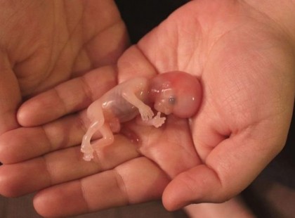 Az abortusz már teljesen legális Írországban!