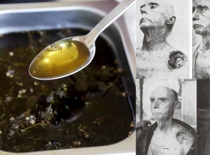 A rák 7 elfelejtett gyógymódja, amit a gyógyszeripar a mai napig elrejt az emberek elől!