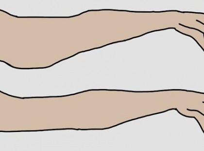 NAPI 3-4 perc és vége a löttyedt karoknak! 1 hét múlva már látható eredmény!!! Íme a gyakorlat :